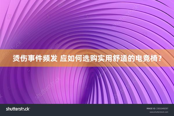 烫伤事件频发 应如何选购实用舒适的电竞椅？